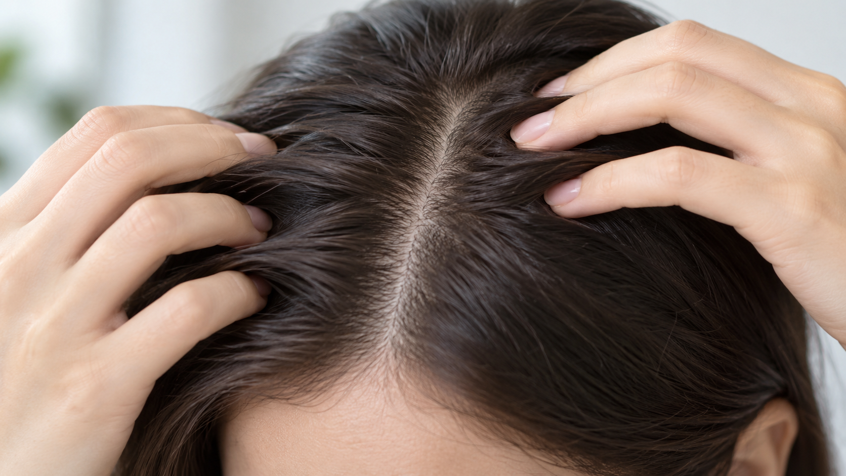 Cuir chevelu irrité : pourquoi il faut l’écouter avant que les cheveux changent