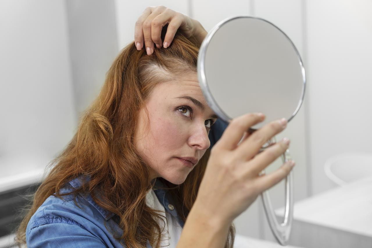 Pourquoi je perds mes cheveux après 30 ans ?  (chute vs casse) à Montréal